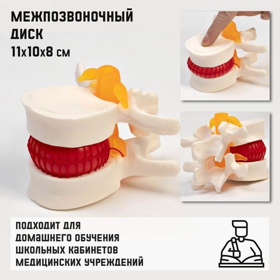 Макет &quot;Межпозвонковый диск&quot; 11*10*8см